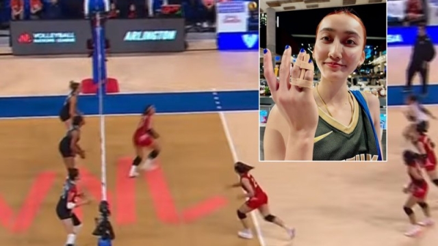 "น้องไก่ วิมลรัตน์" เปิดภาพสุดช๊อก !! สภาพมือหลังจังหวะขึ้นบล็อกลูกตบทีมระดับโลกแคนาดา