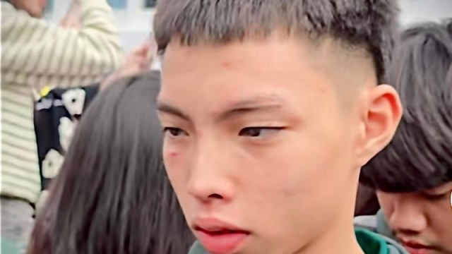 คุณพ่อ “เบอร์ 14 หมอนทองวิทยา” เผยสภาพใบหน้าลูกชายหลังเกมล่าสุด พร้อมให้แง่คิด